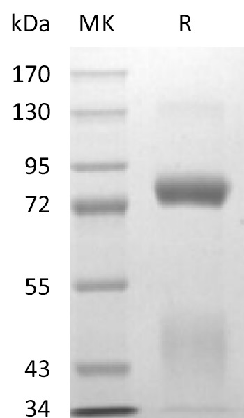 Biotinylated Human HGF R +SDS-PAGE.jpg